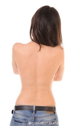 6 Consejos para combatir el acné en la espalda